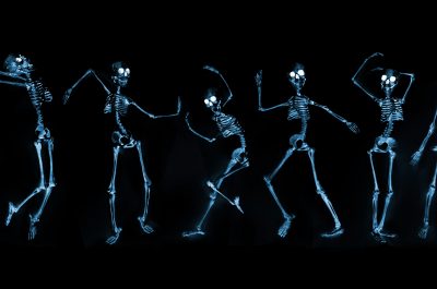 Dancing Skeletons X ray